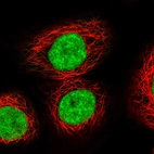 Immunofluorescent staining of human cell line A-431 shows localization to nucleoplasm.
