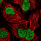 Immunofluorescent staining of human cell line HeLa shows localization to nucleoplasm.