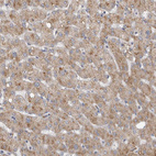 Anti-DHRS4 Antibody