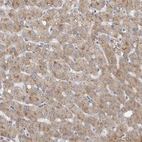 Anti-DHRS4 Antibody