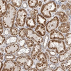 Immunohistochemical staining of human kidney shows moderate granular cytoplasmic positivity in cells in tubules.