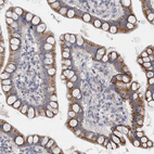 Immunohistochemical staining of human small intestine shows moderate granular cytoplasmic positivity in glandular cells.