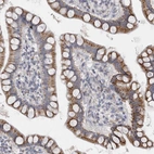 Immunohistochemical staining of human small intestine shows moderate granular cytoplasmic positivity in glandular cells.