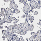 Immunohistochemical staining of human placenta shows no positivity in trophoblastic cells as expected.