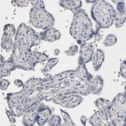 Immunohistochemical staining of human placenta shows no positivity in trophoblastic cells as expected.