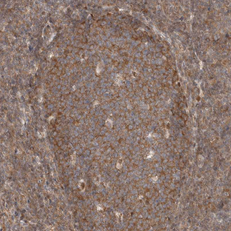 Anti-EIF3E Antibody