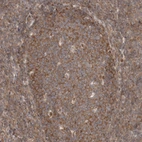 Anti-EIF3E Antibody