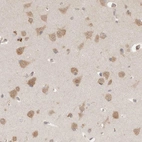 Immunohistochemical staining of human cerebral cortex shows moderate cytoplasmic positivity in neurons.