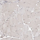 Immunohistochemical staining of human skeletal muscle shows negative to very weak cytoplasmic positivity in myocytes.