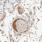 Anti-PROS1 Antibody