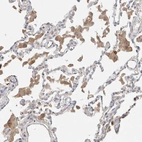 Immunohistochemical staining of human lung shows weak positivity in macrophages.