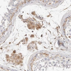 Immunohistochemical staining of human testis shows weak positivity in Leydig cells.