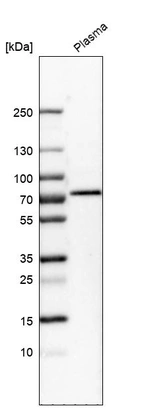 Western blot analysis in human plasma.