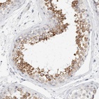 Anti-RTN4 Antibody