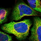 Immunofluorescent staining of human cell line U-2 OS shows localization to endoplasmic reticulum.