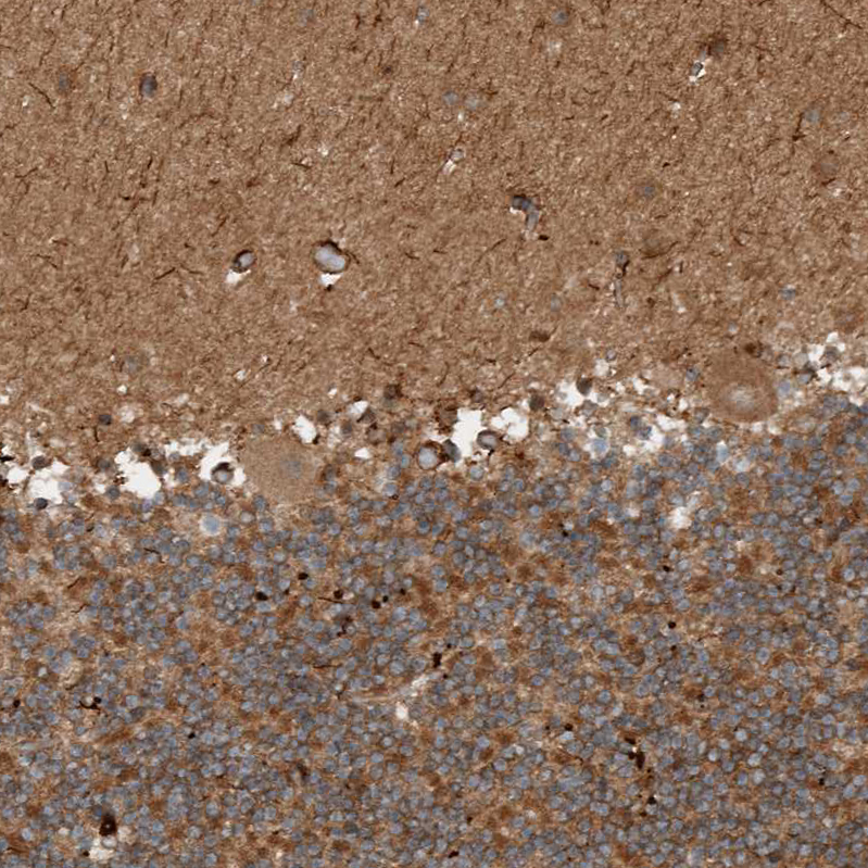 Anti-GIGYF1 Antibody