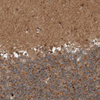 Anti-GIGYF1 Antibody