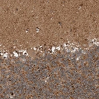 Anti-GIGYF1 Antibody