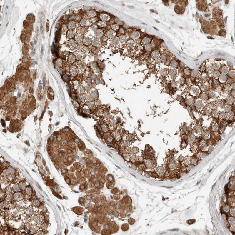 Anti-NBR1 Antibody