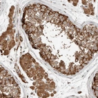 Anti-NBR1 Antibody