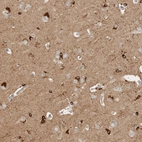 Immunohistochemical staining of human cerebral cortex shows strong cytoplasmic positivity in neurons and glial cells.