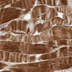 Immunohistochemical staining of human skeletal muscle shows strong cytoplasmic positivity in myocytes.