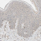 Immunohistochemical staining of human skin shows very weak cytoplasmic positivity in squamous epithelial cells.