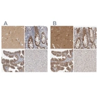 Immunohistochemical staining of human cerebral cortex, colon, fallopian tube and liver using Anti-WIPF2 antibody HPA024000 (A) shows similar protein distribution across tissues to independent antibody HPA024001 (B).