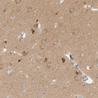 Immunohistochemical staining of human cerebral cortex shows moderate cytoplasmic positivity in neurons.
