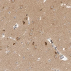 Immunohistochemical staining of human cerebral cortex shows moderate cytoplasmic positivity in neurons.