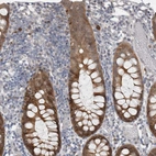 Immunohistochemical staining of human colon shows moderate cytoplasmic positivity in glandular cells.