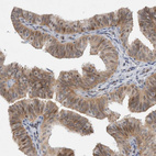 Immunohistochemical staining of human fallopian tube shows moderate cytoplasmic positivity in glandular cells.