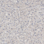 Immunohistochemical staining of human liver shows no positivity in hepatocytes as expected.