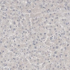 Immunohistochemical staining of human liver shows no positivity in hepatocytes as expected.