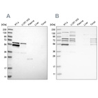 Western blot analysis using Anti-WIPF2 antibody HPA024000 (A) shows similar pattern to independent antibody HPA024001 (B).