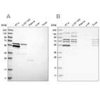Western blot analysis using Anti-WIPF2 antibody HPA024000 (A) shows similar pattern to independent antibody HPA024001 (B).