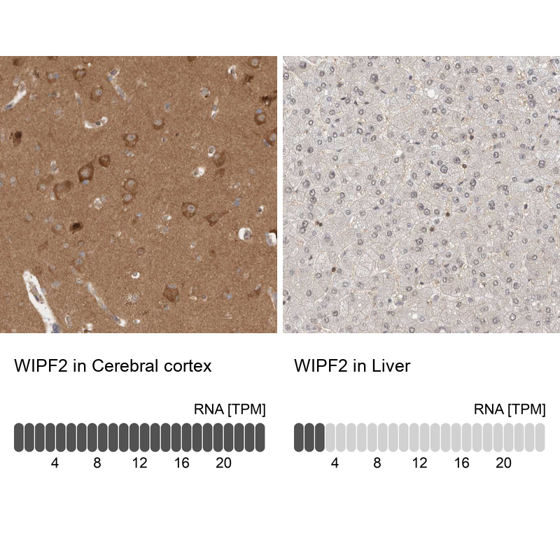 Anti-WIPF2 Antibody