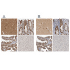 Immunohistochemical staining of human cerebral cortex, colon, fallopian tube and liver using Anti-WIPF2 antibody HPA024001 (A) shows similar protein distribution across tissues to independent antibody HPA024000 (B).