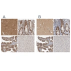 Immunohistochemical staining of human cerebral cortex, colon, fallopian tube and liver using Anti-WIPF2 antibody HPA024001 (A) shows similar protein distribution across tissues to independent antibody HPA024000 (B).