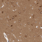 Immunohistochemical staining of human cerebral cortex shows moderate cytoplasmic positivity in neurons.