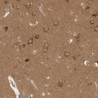 Immunohistochemical staining of human cerebral cortex shows moderate cytoplasmic positivity in neurons.