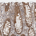 Immunohistochemical staining of human colon shows moderate cytoplasmic positivity in glandular cells.