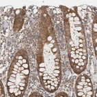 Immunohistochemical staining of human colon shows moderate cytoplasmic positivity in glandular cells.