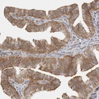 Immunohistochemical staining of human fallopian tube shows moderate cytoplasmic positivity in glandular cells.