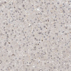 Immunohistochemical staining of human liver shows very weak positivity in hepatocytes.