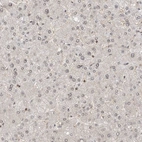 Immunohistochemical staining of human liver shows very weak positivity in hepatocytes.