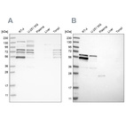 Western blot analysis using Anti-WIPF2 antibody HPA024001 (A) shows similar pattern to independent antibody HPA024000 (B).