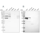 Western blot analysis using Anti-WIPF2 antibody HPA024001 (A) shows similar pattern to independent antibody HPA024000 (B).