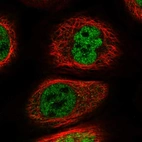 Immunofluorescent staining of human cell line A-431 shows localization to nucleoplasm.