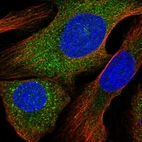 Immunofluorescent staining of human cell line U-2 OS shows localization to cytosol.